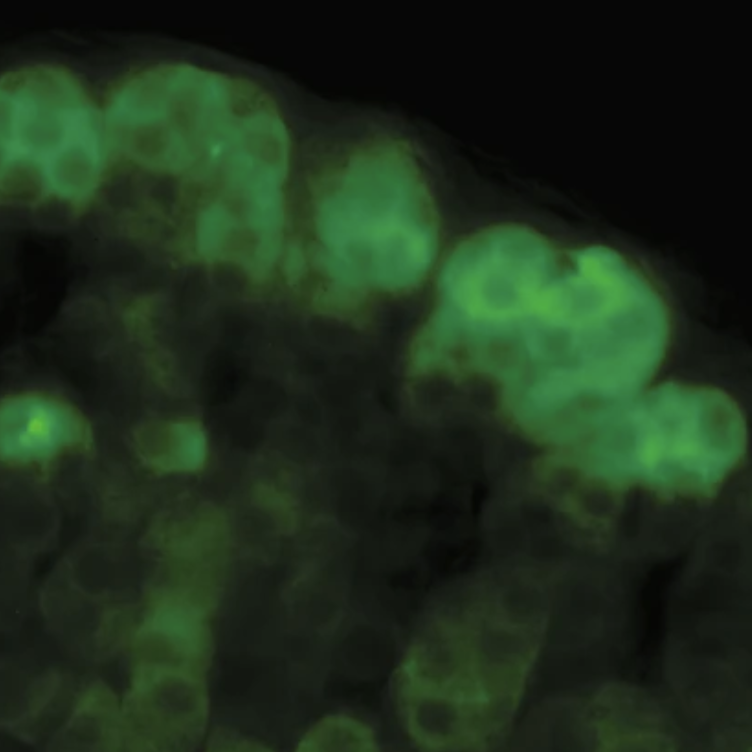 Quantifying Calcium Oscillations