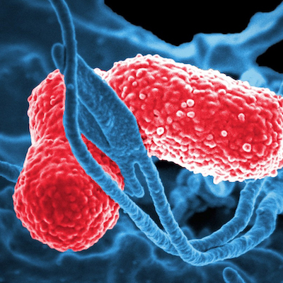 Microbiome Analysis of Hospital Sink Drains